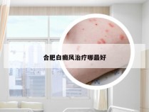 合肥白癜风治疗哪最好