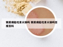 银屑病能吃素火锅吗 银屑病能吃素火锅吗百度百科