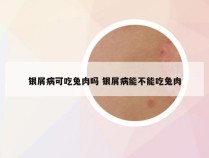 银屑病可吃兔肉吗 银屑病能不能吃兔肉