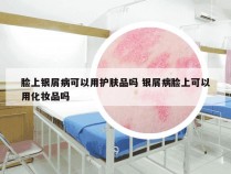 脸上银屑病可以用护肤品吗 银屑病脸上可以用化妆品吗