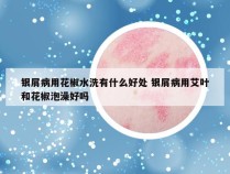 银屑病用花椒水洗有什么好处 银屑病用艾叶和花椒泡澡好吗