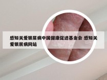 感知关爱银屑病中国健康促进基金会 感知关爱银屑病网站