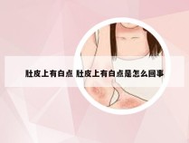 肚皮上有白点 肚皮上有白点是怎么回事