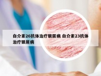白介素26抗体治疗银屑病 白介素23抗体治疗银屑病