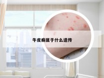 牛皮癣属于什么遗传