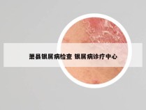 萧县银屑病检查 银屑病诊疗中心