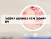 宿迁是银屑病医院甄选楚街官网 宿迁皮肤科医院