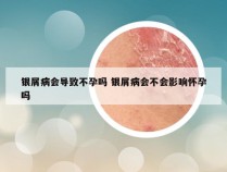 银屑病会导致不孕吗 银屑病会不会影响怀孕吗
