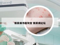 银屑病书籍淘宝 银屑病论坛