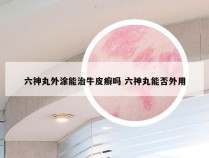 六神丸外涂能治牛皮癣吗 六神丸能否外用