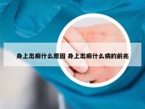 身上出癣什么原因 身上出癣什么病的前兆