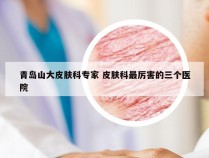 青岛山大皮肤科专家 皮肤科最厉害的三个医院