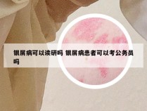 银屑病可以读研吗 银屑病患者可以考公务员吗