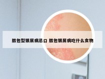 脓包型银屑病忌口 脓包银屑病吃什么食物