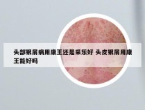 头部银屑病用康王还是采乐好 头皮银屑用康王能好吗