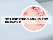 寻常型银屑病能治好吗甄选西安北方 寻常型银屑病治疗方案