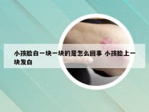 小孩脸白一块一块的是怎么回事 小孩脸上一块发白