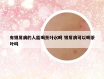 有银屑病的人能喝茶叶水吗 银屑病可以喝茶叶吗