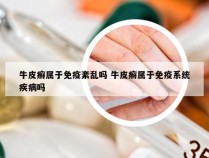 牛皮癣属于免疫紊乱吗 牛皮癣属于免疫系统疾病吗