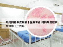 妈妈网看牛皮癣那个医生专业 妈妈牛皮肤癣会遗传下一代吗