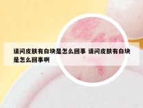 请问皮肤有白块是怎么回事 请问皮肤有白块是怎么回事啊