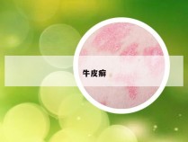 牛皮癣