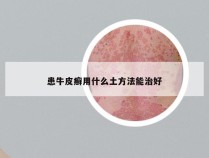 患牛皮癣用什么土方法能治好