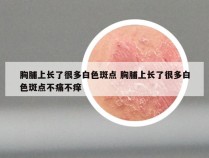 胸脯上长了很多白色斑点 胸脯上长了很多白色斑点不痛不痒