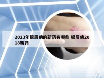 2023年银屑病的新药有哪些 银屑病2018新药