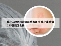 咸宁159医院治银屑病怎么样 咸宁皮肤病195医院怎么样