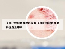 阜阳比较好的皮肤科医院 阜阳比较好的皮肤科医院是哪家