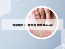 银屑病抗o一定高吗 银屑病aso高