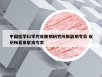 中国医学科学院皮肤病研究所银屑病专家 皮研所看银屑病专家