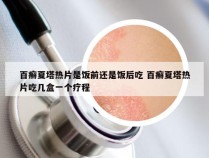 百癣夏塔热片是饭前还是饭后吃 百癣夏塔热片吃几盒一个疗程