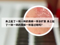 身上起了一块一块的像癣一样会扩散 身上起了一块一块的像癣一样是过敏吗?