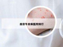 南京牛皮癣医院排行