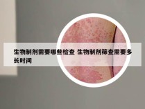 生物制剂需要哪些检查 生物制剂筛查需要多长时间