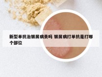 新型单抗治银屑病贵吗 银屑病打单抗是打哪个部位