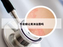 牛皮癣让用沐浴露吗