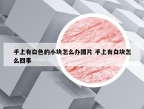 手上有白色的小块怎么办图片 手上有白块怎么回事