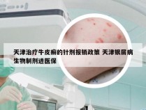 天津治疗牛皮癣的针剂报销政策 天津银屑病生物制剂进医保