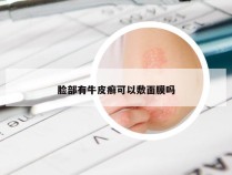 脸部有牛皮癣可以敷面膜吗