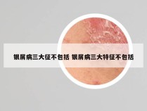 银屑病三大征不包括 银屑病三大特征不包括