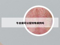 牛皮癣可以报特殊病例吗