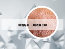 喝酒起癣 一喝酒就长癣