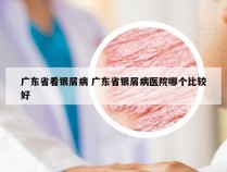 广东省看银屑病 广东省银屑病医院哪个比较好