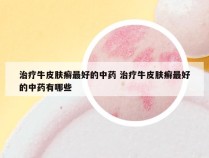 治疗牛皮肤癣最好的中药 治疗牛皮肤癣最好的中药有哪些