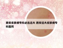 西安皮肤病专科必选远大 西安远大皮肤病专科医院