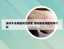 潍坊牛皮癣医院在哪里 潍坊银屑病医院哪个好