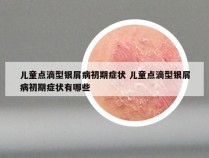 儿童点滴型银屑病初期症状 儿童点滴型银屑病初期症状有哪些